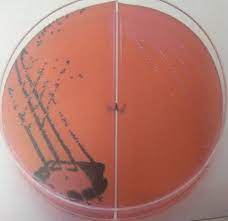 Salmonella growing on xld agar. Xylose Lysine Deoxycholate Xld Agar Composition Preparation Results And Uses Learn Microbiology Online