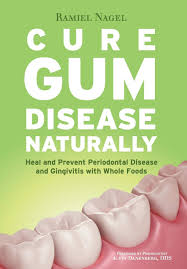 How to effectively reverse gum disease 1. Cure Gum Disease Naturally Heal And Prevent Periodontal Disease And Gingivitis With Whole Foods Nagel Ramiel Danenberg Dds Alvin 9780982021361 Amazon Com Books