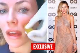 Abbey Clancy gets her face injected with two gold-coated needles to keep  her skin looking young