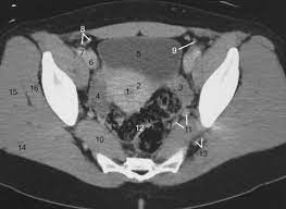 We did not find results for: The Pelvis Radiology Key