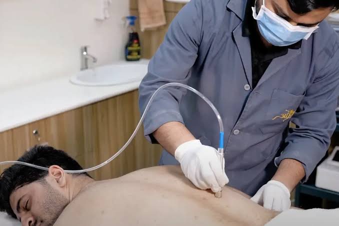 Body care consultation at Profrea