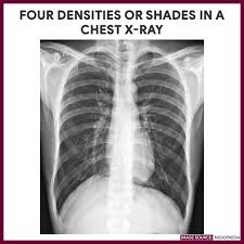Chest X Ray Chest Radiography Nurse Study Guide Nursing Study Guide Nursing Study X Ray