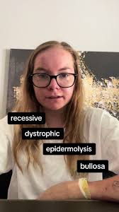 Understanding Recessive Dystrophic Epidermolysis Bullosa (RDEB)