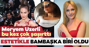We did not find results for: Meryem Uzerli Estetik Yaptirdi Iste Meryem Uzerli Nin Son Hali Galeri Magazin