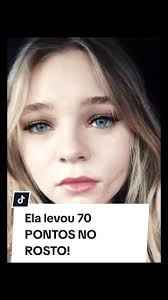 Taylor Hickson sofreu grave acidente nos bastidores de A Casa do Medo