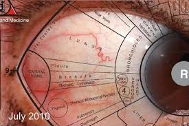 sclerology the study of the markings in the whites of the