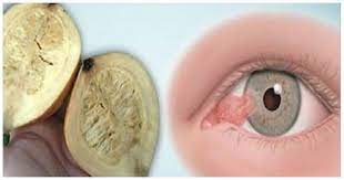 In This Article We Re Going To Present You A Recipe For Better Vision You Ll Improve Your Vision But You Ll Al In 2020 Eye Sight Improvement Health Natural Remedies