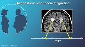 Resonancia magnética, que puede revelar zonas de esclerosis múltiple (lesiones) en el cerebro y la médula espinal. El Neurologo Considerara La Posibilidad De Diagnosticar Em Si La Resonancia Magnetica Muestra Al Menos Dos Areas Esclerosis Esclerosis Multiple Medula Espinal
