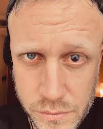 I am very sorry to cancel another two gigs. Actually I am in hospital in  Rome now because i can not see anything anymore