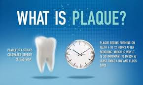 Image result for Plaque