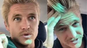 Balding Man Regains Shiny Hair After he Gave up Shampooing