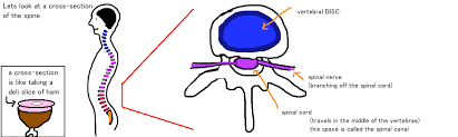 We did not find results for: Spine Lumbar Disk Herniation Pinched Nerve Bone Talks