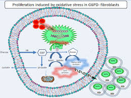 Image result for G6PD Deficiency