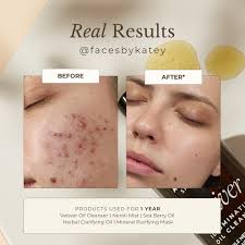 Witness the rejuvenating magic of natural sea berry oil skincare in  Tiffany's luxurious holistic facial at her Madison Crown Skin facial studio  😍 Madison Crown Skin's signature 75-min service showcases Apoterra's  products