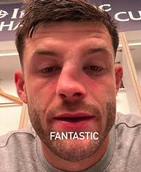 Speedy recovery, Blair Kinghorn! 📸: @blairkinghorn