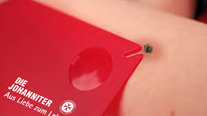 Da die kleinen parasiten allerdings einige ernsthafte. Was Tun Nach Einem Zeckenbiss Neustadt Gefluster