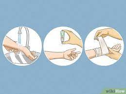So, you can remove cactus prickles stuck in your appendage with tweezers or a sharp needle, or you can use. 3 Ways To Remove Cactus Needles Wikihow