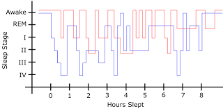 Restless Legs Syndrome Wikipedia