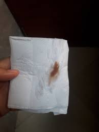 Sangrado De Implantacion Primeros Sintomas Babycenter