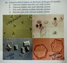 Kidney Stone Shapes Option B Is Correct Study Materials Medical Studies Kidney Stones
