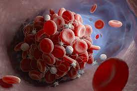 Testing Tpa To Break Blood Clots In Covid 19 Patients Uchealth Today