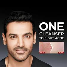 Acne Studio Acne Fayze Cur-Acne Gel का उपयोग, फायदे ,साइड इफेक्ट