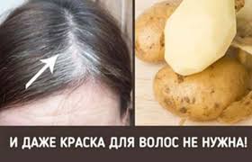 как избавиться от перхоти в домашних условиях быстро и эффективно Kak Prosto Izbavitsya Ot Sediny V Domashnih Usloviyah Sedye Volosy Lekarstva Dlya Volos Maski Dlya Volos