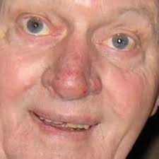 Tributes paid to Rossendale Rugby Club founder Alec Burton