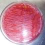 مخبران?q=https://www.researchgate.net/figure/Characteristics-of-Escherichia-coli-on-Sorbitol-MacConkey-Agar-Note-the-pinkish-colonies_fig4_322642919 from www.researchgate.net