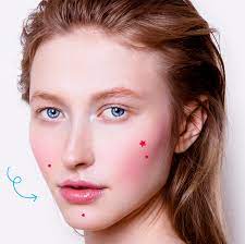 Check spelling or type a new query. Papulopustular Rosacea How To Treat Your Acne Rosacea Breakouts