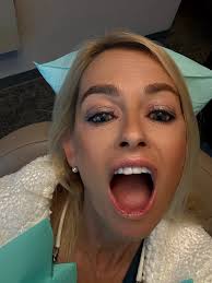 OH MY … another early morning visit w the dentist 🦷… it's getting real …  and I'm getting more and more overwhelmed… 😫😳 … yes 🙌 eventuell there  will be a beautiful