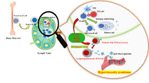 Image result for Hyperviscosity Syndrome