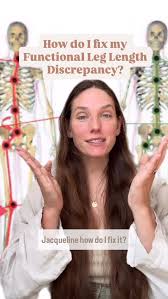 Image result for Functional Leg Length Discrepancy