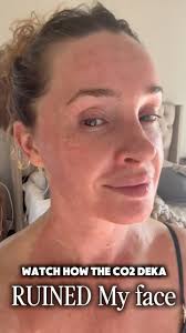 Hi! My name is Taby! Owner of Youth Fairy Clinique 💋 Want to book with me?  Call, text, DM or email to book! ✨ 📍2003 West Kennedy Blvd. Tampa, Florida  33606 📱813-205-1069