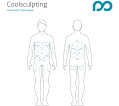 At first, these terms can be confusing to the student of strength. Coolsculpting Korpergestaltung Laser Centrum Behandlungen Poliklinik Milojevic