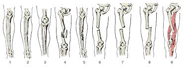 Tusenvis av nye høykvalitetsbilder legges til daglig. Beinbrudd Store Medisinske Leksikon