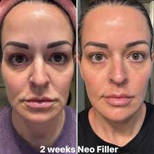 This is one of those moments! Don't miss it! Learn how this will change the  industry~ and lives! Go to livewithpuya.com tonight Sun 1/23/25 6pm pacific  #thisisbig #neoraprelaunch #thefutureoffiller message me to