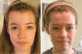 My Experience With The Mary Kay Clear Proof Acne System Designs By Miss Mandee