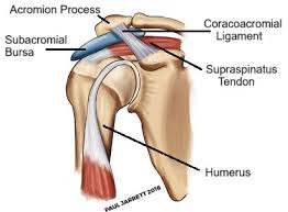 Image result for Subacromial Space Injection