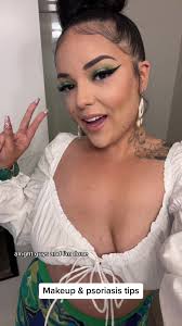 How to Hide Plaque Psoriasis