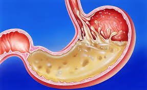 Pin On Dr Justin Marchegiani Justin Health