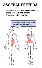 Visceral Pain Referral Snapspt