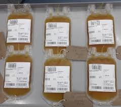 Image result for Plasma Transfusion