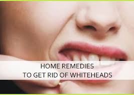 We did not find results for: Home Remedies To Get Rid Of Whiteheads Fast Naturally