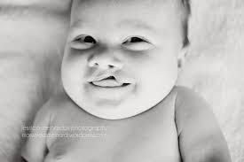 Cleft Lip