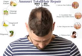 Are you eager to find out how to strengthen hair follicles? Ammuri Anti Hair Loss Hair Serum For Hair Thinning Balding Repair Hair Follicles Great For Slow Growing Hair Hair Growth Problems For Men And Women Ammuri Skincare