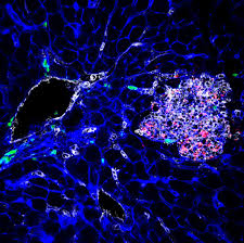 Listeria monocytogenes is a type of bacteria that can cause food poisoning. How Dormant Listeria Hides In Cells