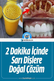 2 Dakika Icinde Sari Dislere Ev Yapimi Dogal Cozum Faydali Bilgin Bitkisel Tarifler Dogal Dis Beyazlatma Yiyecek Ve Icecek