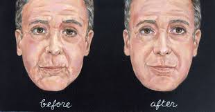 Glaser Dental (tylerglaserdds)