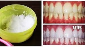 Gigi jadi satu diantara organ tubuh yang penting untuk manusia yang memiliki fungsi ampuh sebagai penghancur makanan. Putihkan Gigi Kuning Dalam Hitungan Menit Dengan Ramuan Ini Beauty Fimela Com